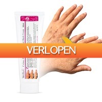 Actie.deals 3: Wellys anti-vlekken creme voor gezicht en lichaam