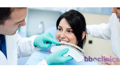 Wowdeal: Tandenbleken bij BBO Clinics