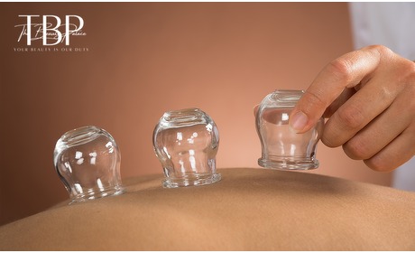 Social Deal: Cuppingmassage bij The Beauty Palace